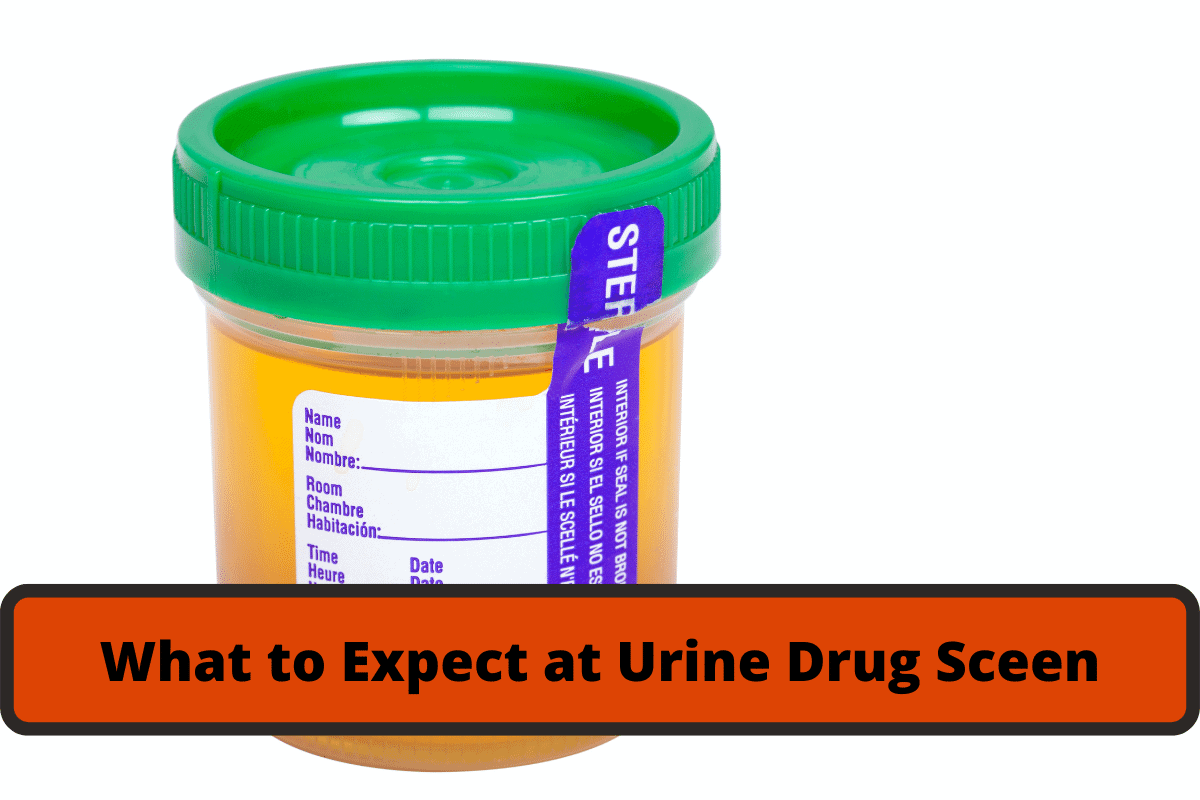 what to expect at the urine drug screen